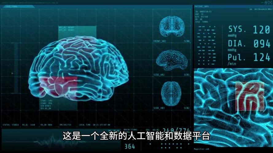 人工智能 ibm watson