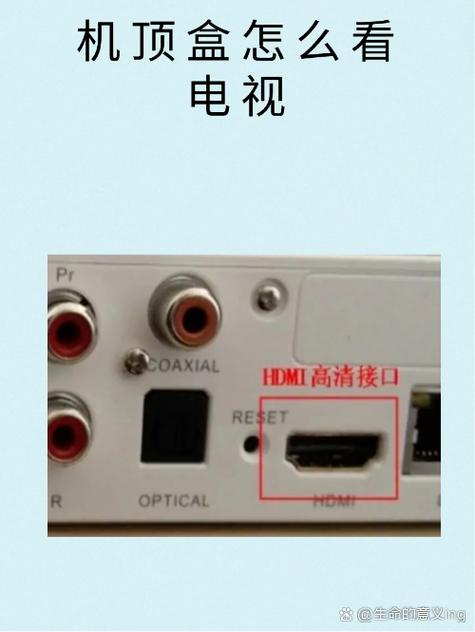 机顶盒怎么连接智能电视